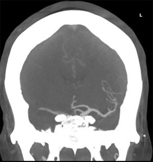 SELECT2 Figure 1